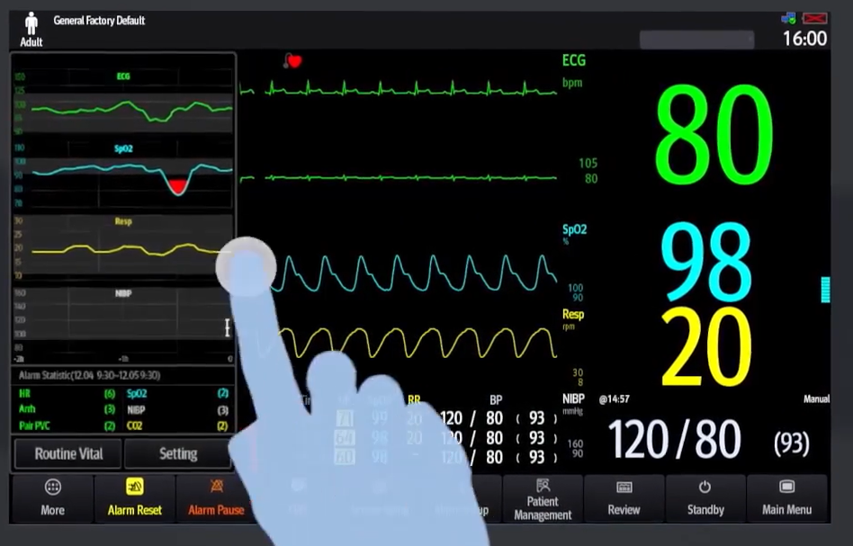 MONITOR (epM10) main unit+touchscreen 10.1"
